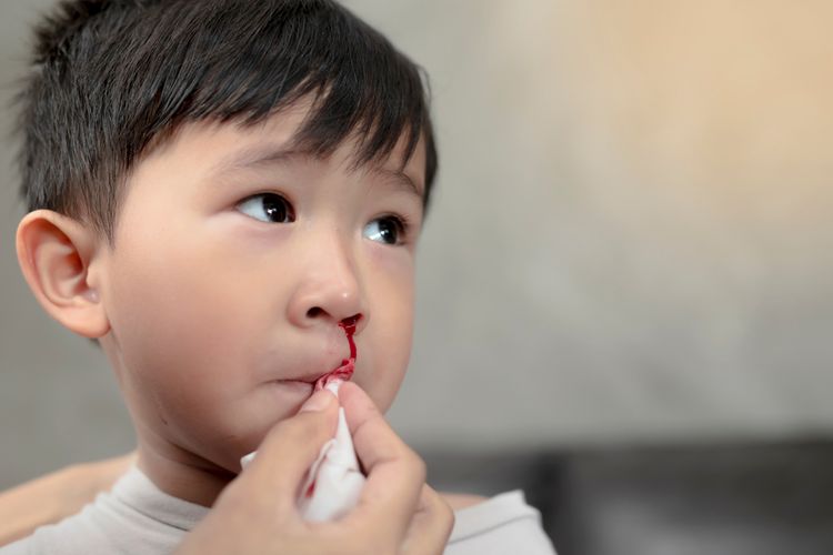 Understanding Nosebleeds and How to Treat Them