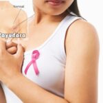 Understanding and How to Treat Breast Abscesses in Postpartum Women